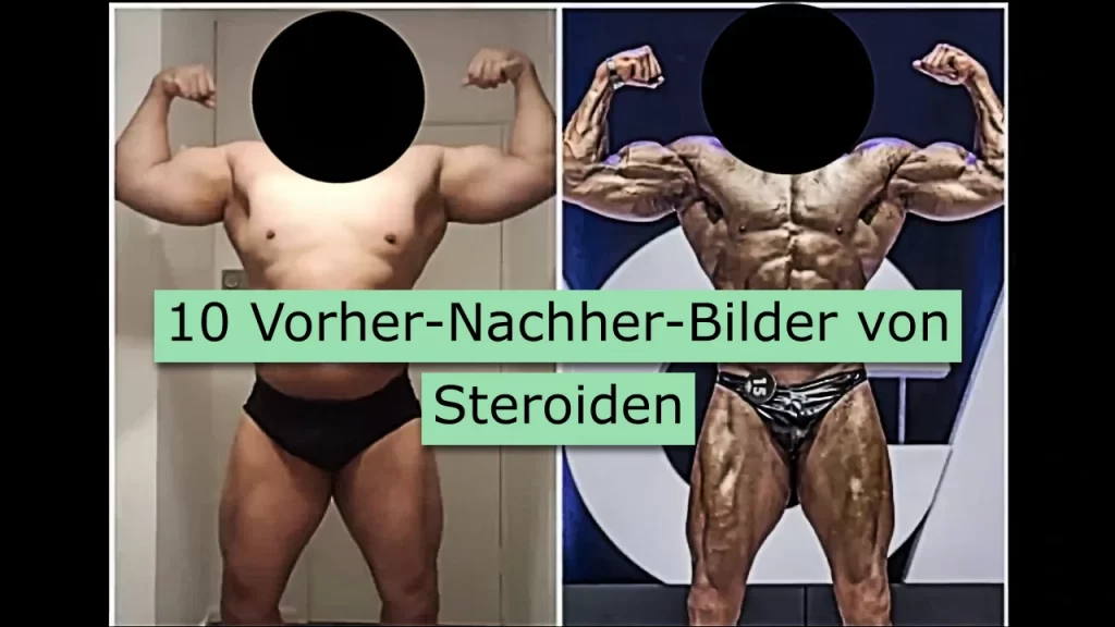 10 Vorher-Nachher-Bilder von Steroiden