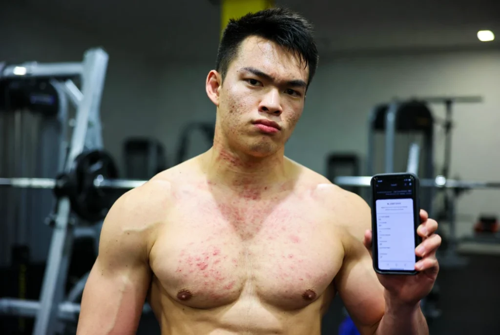 Schlanker männlicher Bodybuilder in einem Fitnessstudio, der leichte Nebenwirkungen der Boldenon-Anwendung zeigt: leichte Wassereinlagerungen, leichte Akne auf den Schultern und erhöhter Hämatokritwert, der auf dem Bluttest-Alarm seines Telefons angezeigt wird – dies spiegelt reale, nicht übertriebene Risiken wider, die in Anwenderberichten und klinischen Beobachtungen dokumentiert sind.